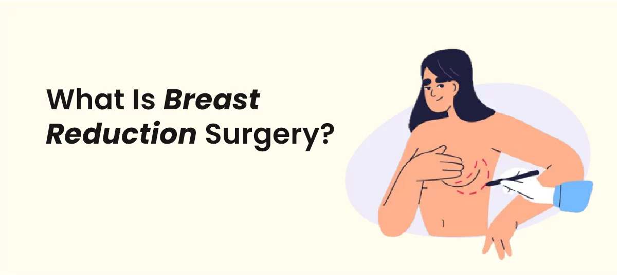 what is breast reduction surgery